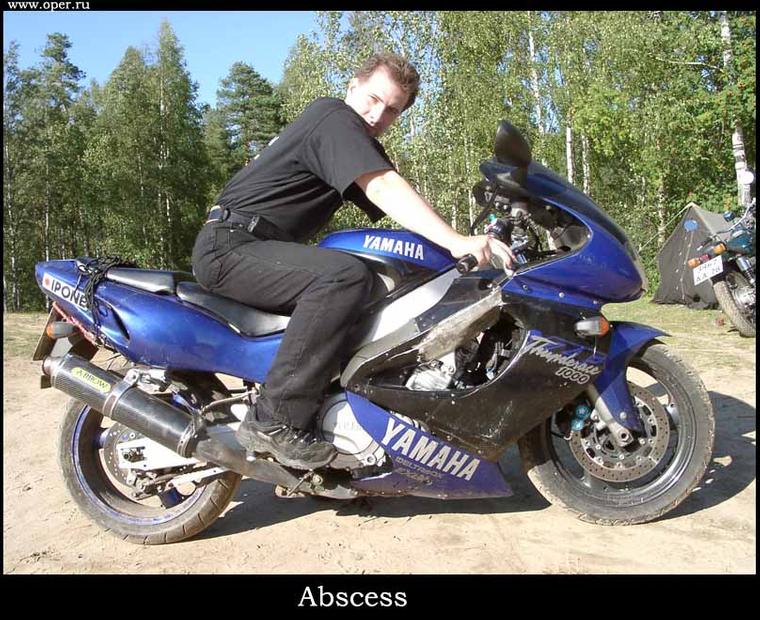 Abscess 