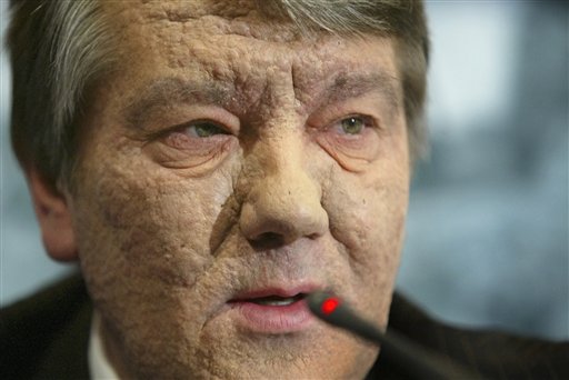 Выпил яду